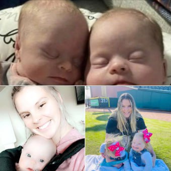 “I wouldn’t want those babies” 😭 one, cruel troll said. “If my babies were born like that, they’d be put up for adoption,” another told the girls’ mother. Fortunately, this brave mom had the ideal response to critics of her beautiful twins. Check the comments 👇👇👇
